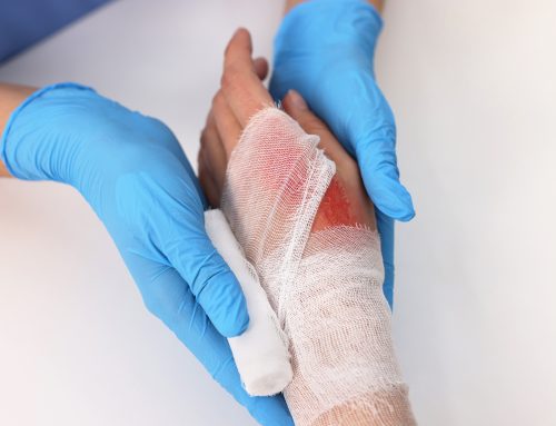 Wound Care Services Offered at Anchor Restorative