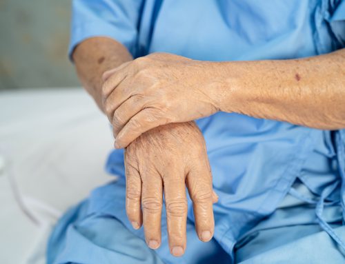 Treatment Options for Rheumatoid Arthritis at Anchor Restorative Medicine