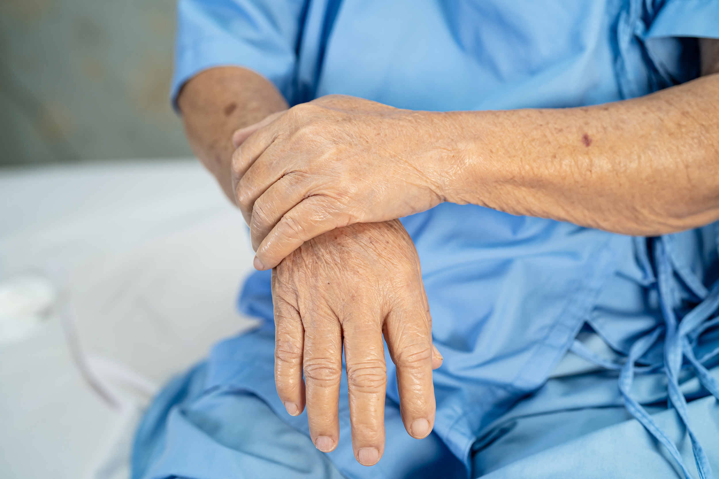 Rheumatoid Arthritis