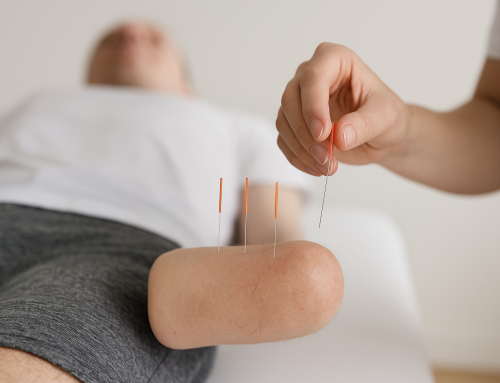 Acupuncture for Phantom Limb Pain: How It Helps, What the Evidence Says, and What to Expect